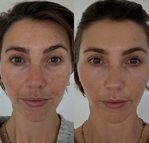 DermaLift™: Activación Real de Colágeno | 50% OFF